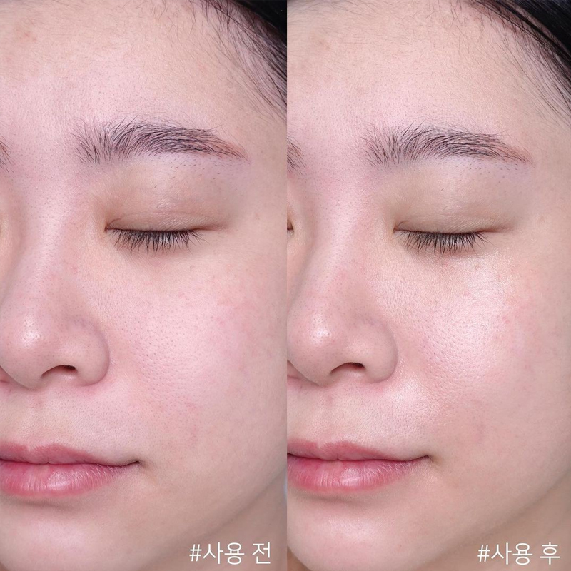 Centella Asiatica Time Reverse - Skincare Centella review and price